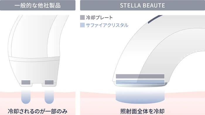 ステラボーテ IPL光美容器