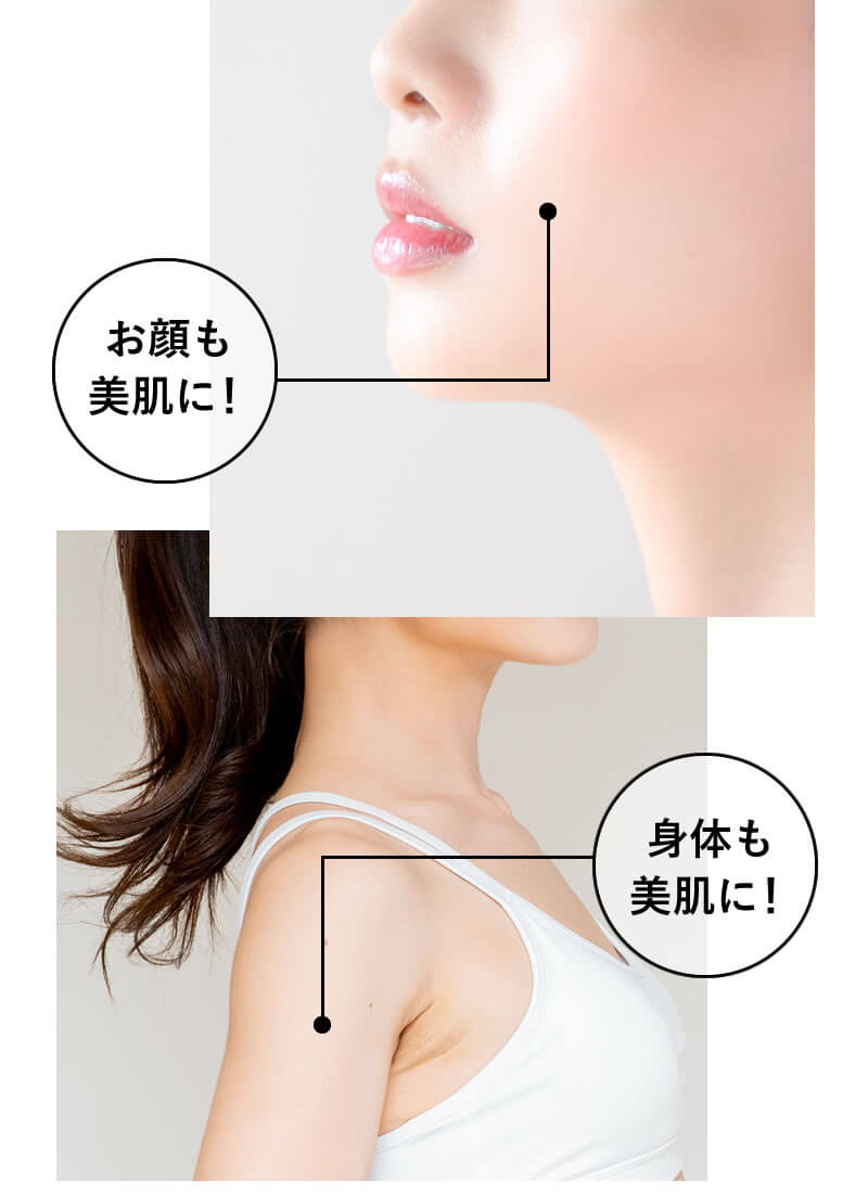 ステラボーテ IPL光美容器